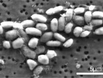 ヒ素で成長する細菌発見の論文、サイエンスが撤回　15年前に話題