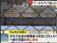 炎天下の水泳授業で小学生62人が尻にやけど！プールサイド長時間座ると気づかぬうちに「低温やけど」も…防止には履き物移動などの徹底を