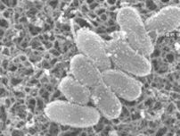 【注意】百日ぜき以外も…”アデノウイルス”流行で大人も感染「日常生活もきつい」発熱や結膜炎などの症状　こまめな手洗いなどで予防