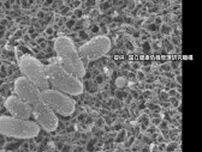 【速報】「百日咳」新規感染者数が4週連続で過去最多…全国感染者数3682人　東京が最多、次いで埼玉、群馬