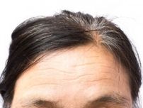 老け見え顔の一因！眉毛の上が膨らんでいるのは筋肉？腫れ？できる原因と対策・治療法