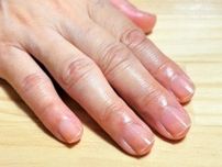 夏到来！　爪をきれいに　健康的に【前編】札幌市内の「自爪育成」サロン紹介　＜１０区スペシャル＞