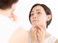乾燥肌なのに“顔のUゾーン”に「ニキビ」　医師に聞いてわかった“思春期ニキビ”との根本的な違い