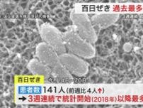 宮城県内で百日ぜき急拡大　過去最多の１４１人に　１４歳までの子供が８割以上　県が対策呼びかけ