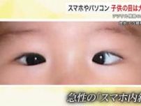 子供に増えるスマホ内斜視　ある日突然、寄り目に…眼科医に聞く対処法　背景に学習デジタル化とコロナ禍