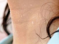 役所にも病院にもクーラーがない…｢地球のために｣入院患者の病室が30度に達するドイツ｢脱炭素｣の空回り