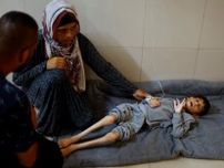 ガザ、栄養失調の子ども救う治療食が不足　国連など活動の危機