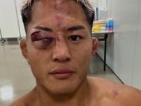 RIZIN 大雅が敗戦後も前向きコメント「この道を正解にする為、戦い続けます」