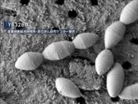がん治療効果高める腸内菌発見　国立がん研究センターなどが発表