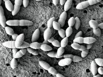 「免疫チェックポイント阻害薬」の作用に関わる腸内細菌を特定…国立がん研究センターが発表